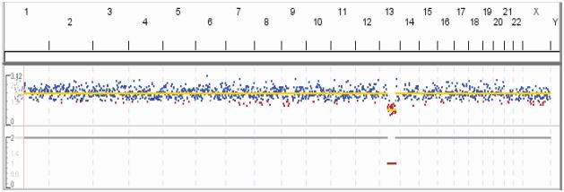 Detecção de aneuploidia em uma única célula isolada FACS, utilizando o kit Ion ReproSeq NGS Overnight. Os dados mostram o desvio (em vermelho) na linha base, indicando monossomia do cromossomo 13 e duas cópias dos autossomos remanescentes do cromossomo X.