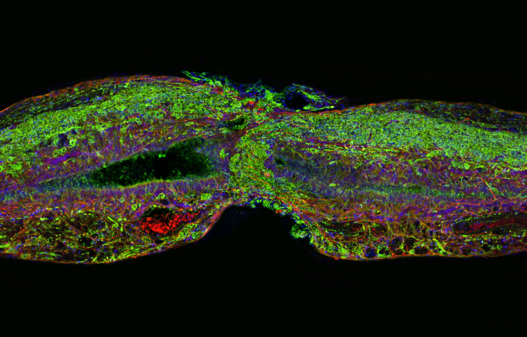 Peixes-zebra adultos são capazes de regenerar suas medulas espinhais depois de uma severa e completa injúria. Este close-up das células envolvidas revela que as células glial de suporte (mostradas em vermelho) são as primeiras a cruzar a lacuna entre as terminações afetadas. As células neuronais (verde) logo as seguirão. Os pesquisadores do Duke Regeneration Next descobriram que a proteína na glia, chamada fator de crescimento do tecido conectivo, ou CTFG, é crucial para este processo. Foto: Mayssa Mokalled e Kenneth Poss, Duke University